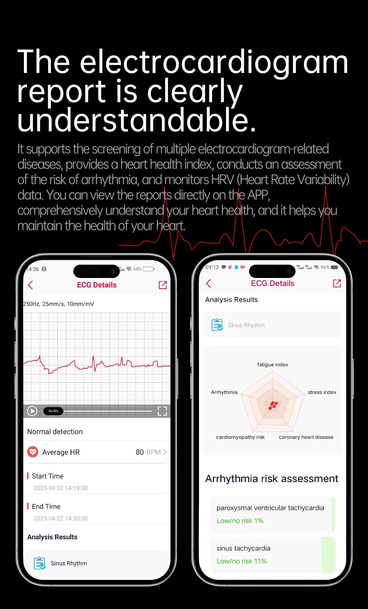novo smartwatch 2025 ECG+PPG análise precisa de ácido úrico pressão arterial análise corporal de órgãos chamadas em HD